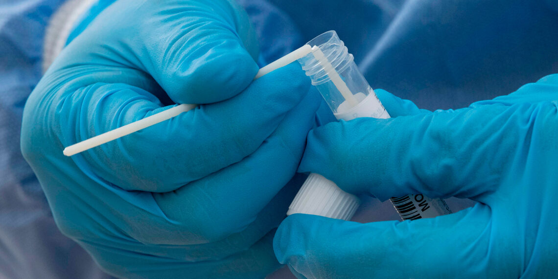 Health personnel breaks a swap to put it into the collection tube after taking a smear at a drive-in coronavirus testing station in Nuertingen, southern Germany, on November 10, 2020, amid the novel coronavirus COVID-19 pandemic. (Photo by THOMAS KIENZLE / AFP) (Photo by THOMAS KIENZLE/AFP via Getty Images)