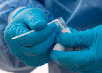 Health personnel breaks a swap to put it into the collection tube after taking a smear at a drive-in coronavirus testing station in Nuertingen, southern Germany, on November 10, 2020, amid the novel coronavirus COVID-19 pandemic. (Photo by THOMAS KIENZLE / AFP) (Photo by THOMAS KIENZLE/AFP via Getty Images)