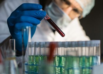 Researcher looking on blood sample in test tube. Focus on test tube.